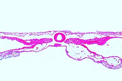 Mikropräparat - Huhn, 36 Stunden alter Keim, quer: Neuralrohr, Chorda, Differenzierung des Mesoderms: Myotom, Nephrotom Splanchnotom