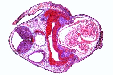 Mikropräparat - Frosch, Thorax oder Abdomen der jungen Kaulquappe, quer