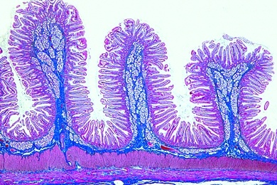 Mikropräparat - Zwölffingerdarm (Duodenum), Mensch, quer