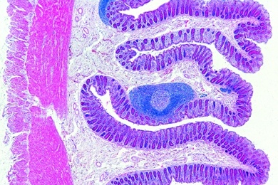 Mikropräparat - Dickdarm (Colon), Mensch, quer
