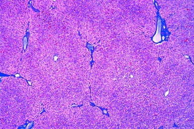 Mikropräparat - Leber, Mensch, quer