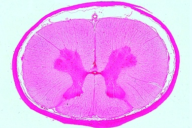Mikropräparat - Rückenmark, Mensch, quer