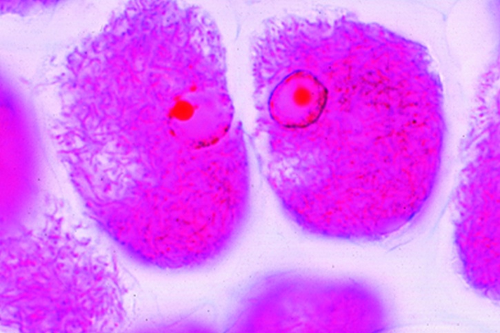 Mikropräparat - Rhizobium radicicola, stickstoffbindende Bakterien in den Wurzelknöllchen der Lupine. Schnitt