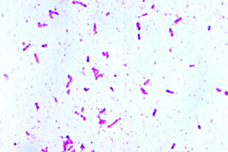 Mikropräparat - Rhizobium radicicola, Ausstrich