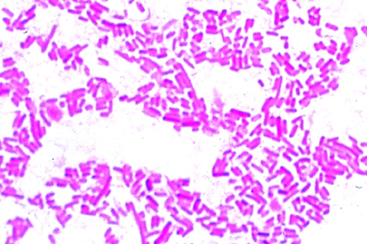 Mikropräparat - Salmonella enteritidis. Wurstvergiftung. Ausstrich