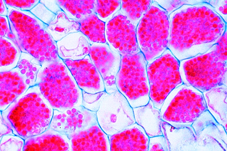 Mikropräparat - Actinomyces alni. Wurzelknöllchen mit Mykorrhiza der Erle. Schni