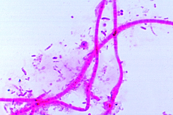 Mikropräparat - Sphaerotilus natans. Abwasserbakterium. lange Ketten mit Schleim