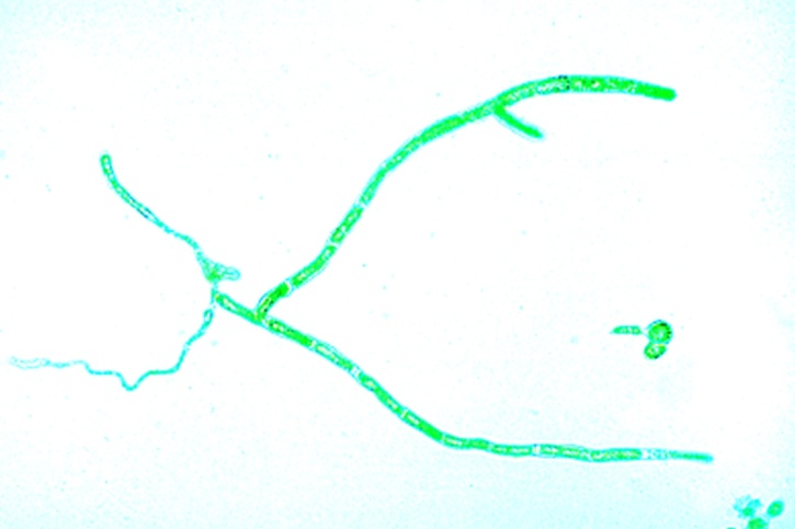 Mikropräparat - Mnium, Protonema (Vorkeim) mit Brutknospen, total