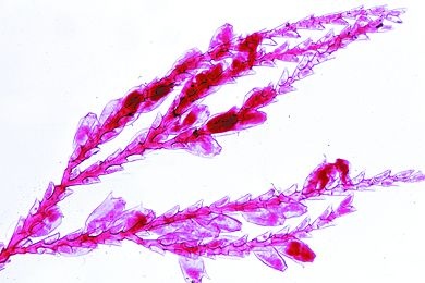 Mikropräparat - Sertularia cupressina, Seemoos, total