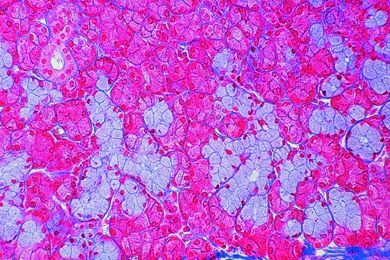 Mikropräparat - Unterkieferspeicheldrüse (Gl. submandibularis), quer