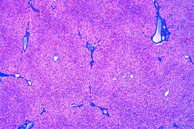 Mikropräparat - Leber des Menschen, quer