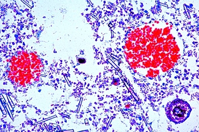 Mikropräparat - Spongilla, Süßwasserschwamm (Kieselschwamm)