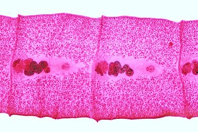 Mikropräparat - Diphyllobothrium latum, reife Proglottiden, total*