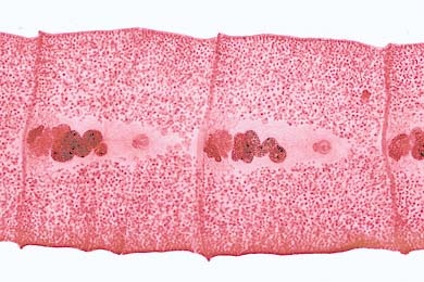 Mikropräparat - Diphyllobothrium latum, reife Proglottiden, quer