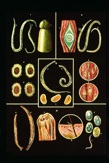 Anatomische Wandkarte Darmpararsiten