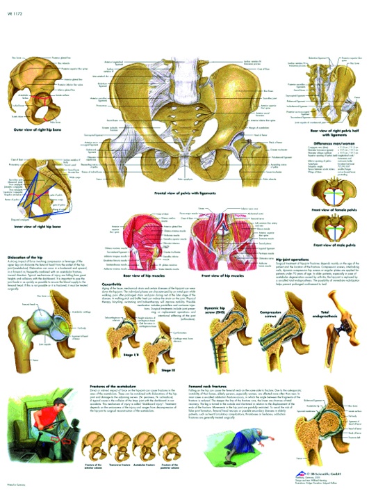 Anatomische Lehrtafel, Becken und Hüfte - Anatomie und Pathologie