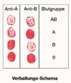 künstliches Blut: Experimentier-Kit de Luxe