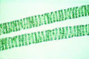 Mikropräparate in Serie - Algen (Algae), 30 Präparate mit Begleittext