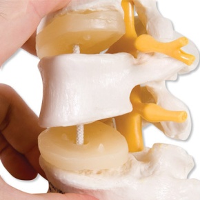 3 Lendenwirbel mit Spinalnerven und Rückenmark, elastisch montiert