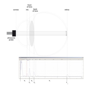 Augenmodell für Ultraschallbiometrie